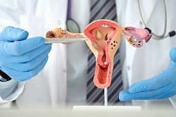 gyne